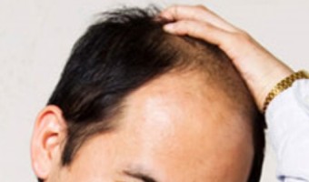 キャプチャ110①